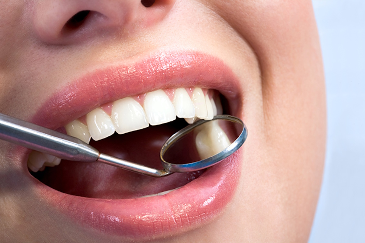 Periodoncia en Dental Valls Periodoncia en Dental Valls